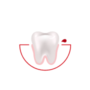 Hoe vaak bloedt je tandvlees tijdens het poetsen of flossen?